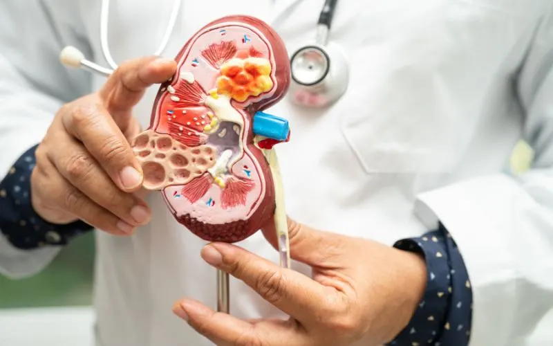 NEPHROLOGY TREATMENT